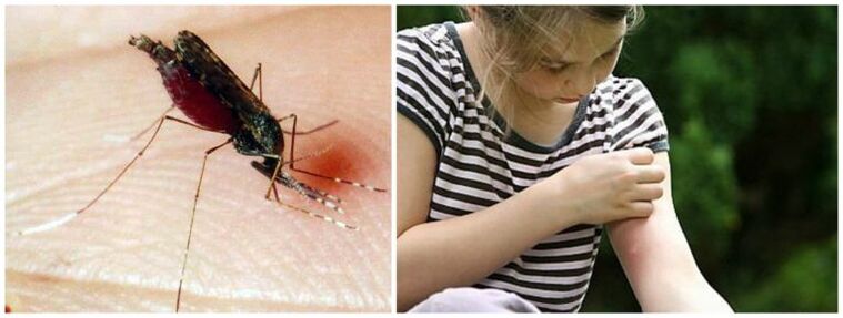 Τα επώδυνα εξογκώματα μετά από τσίμπημα κουνουπιού μπορεί να είναι σύμπτωμα διροφιλαρίωσης