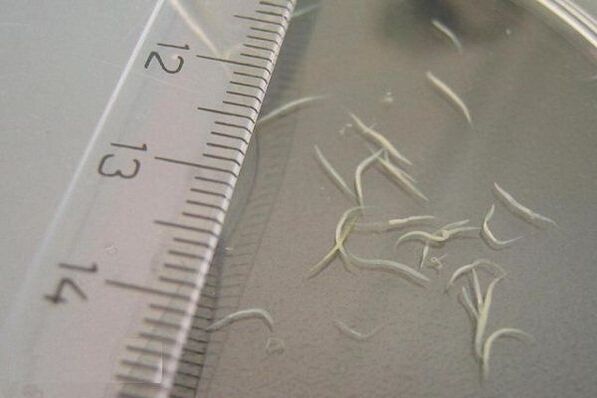πώς μοιάζουν τα pinworms