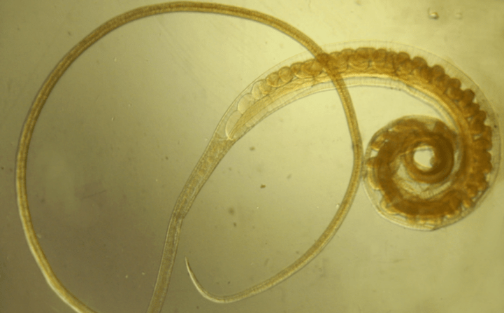 Human whipworm - ένα σκουλήκι που επηρεάζει νεαρά άτομα