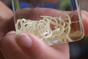 Παράσιτα από το ανθρώπινο σώμα